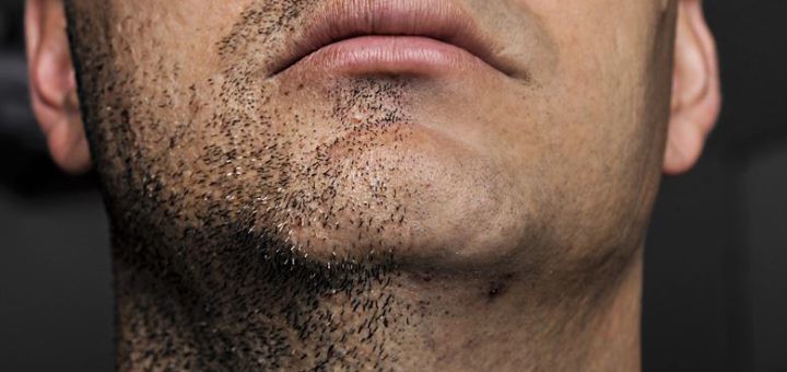 Shaving cream product for ingrown hairs — targeted formulation for prevention